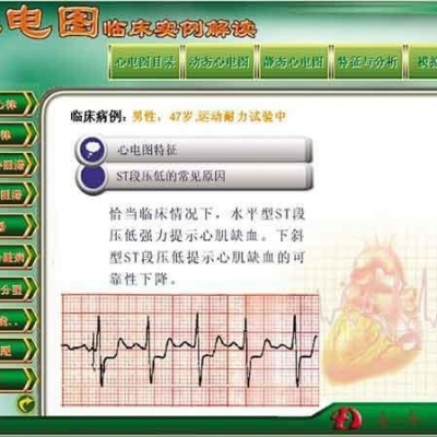 新版心电图教学软件