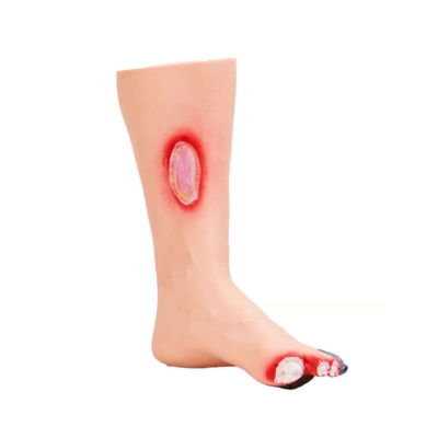 高级糖尿病足护理模型(带小腿)